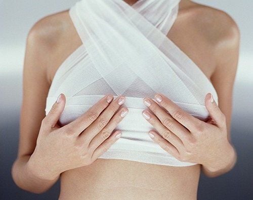 Post-breast augmentation, avoidance of vigorous activities is required for a duration of three months.
