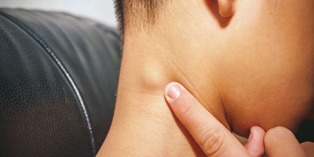 Lymph nodes are associated with the problem of lumps on the back of the head.
