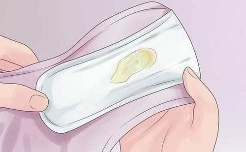 The change in vaginal discharge signals the approaching menstrual period.