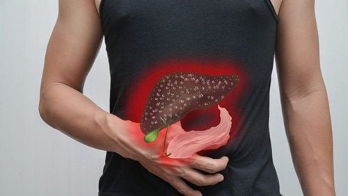 Symptoms in the Late Stages of Liver Cancer