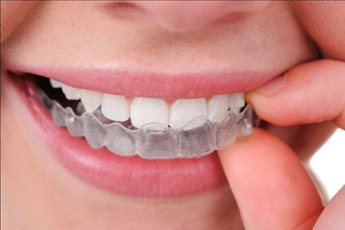 Braces help correct misaligned teeth