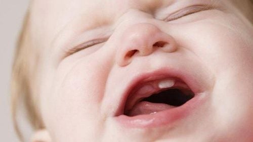 What is considered late teething?