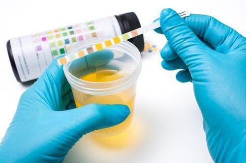 Urinalysis aids in diagnosing toxemia. 