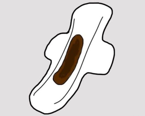 Brown Mucous Discharge from the Vagina – A Sign of Labor?