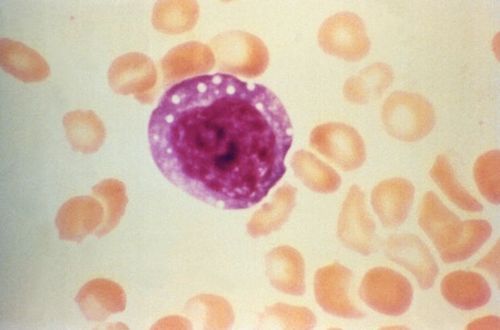 Image of atypical cell
