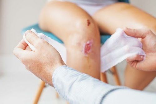 Prompt hemostasis enhances wound healing outcomes.