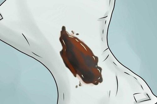 Brown discharge during pregnancy