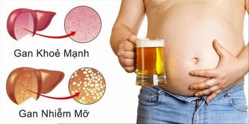 What medicine should be taken for fatty liver?