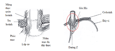 Figure 3: The lower esophageal sphincter, His angle, and the esophageal-diaphragmatic membrane play an important role in gastroesophageal reflux disease (GERD).