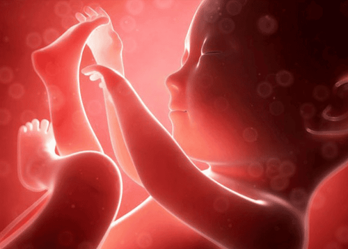 What color is amniotic fluid? Common abnormalities associated with amniotic fluid