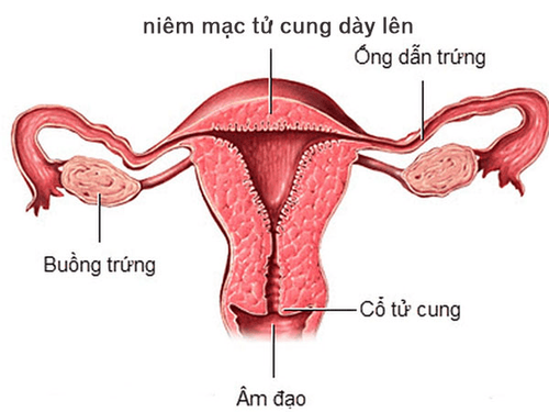 How to fix thick uterine lining