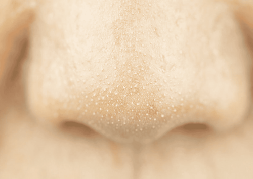 What Is the White Substance Released When You Squeeze Pimples on Your Nose?